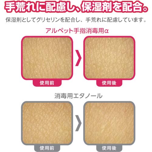 サラヤ アルペット手指消毒用アルファ 1L P付 41231